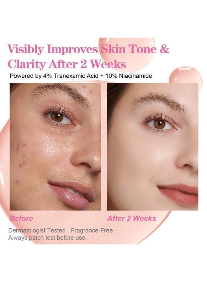 Glossy TXA 4% + Niacinamide 10% Face Serum | Anti-Wrinkle & Dark Spot Corrector | For Sensitive Skin | Hydrating Glow Facial Serum with Tranexamic Acid | Korean Skincare | 30mL - Image 3